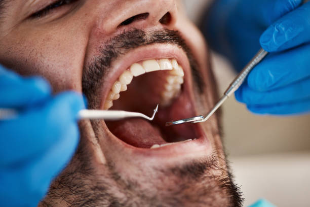 Dental X-Rays and Imaging in Mineral Point, WI